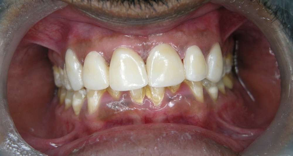 Patient 7 After