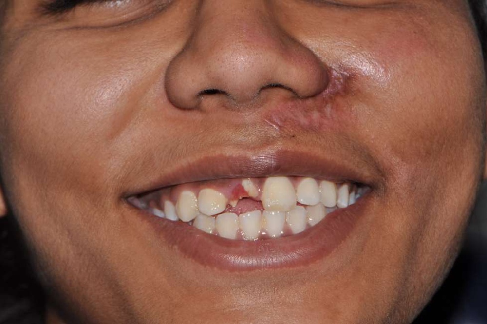 Patient 9 Before
