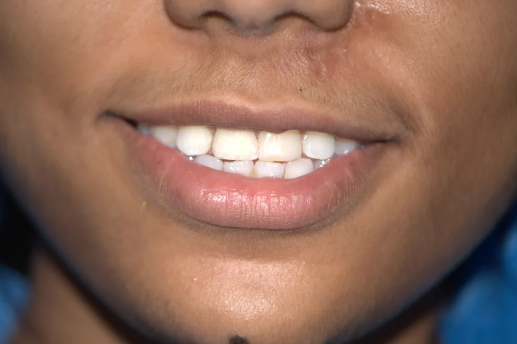 Patient 9 After
