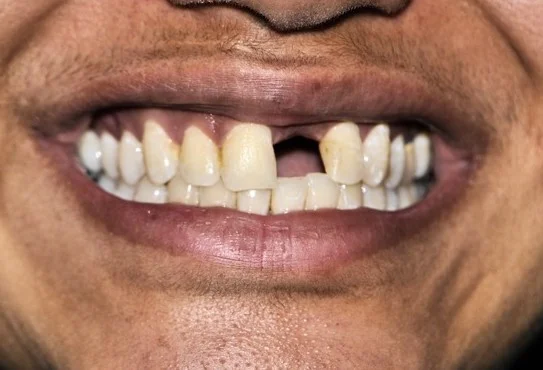 Before Dental Treatment